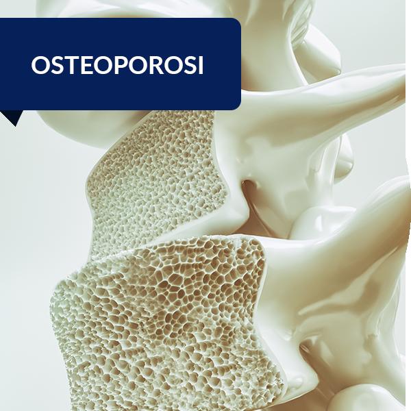 OSTEOPOROSI