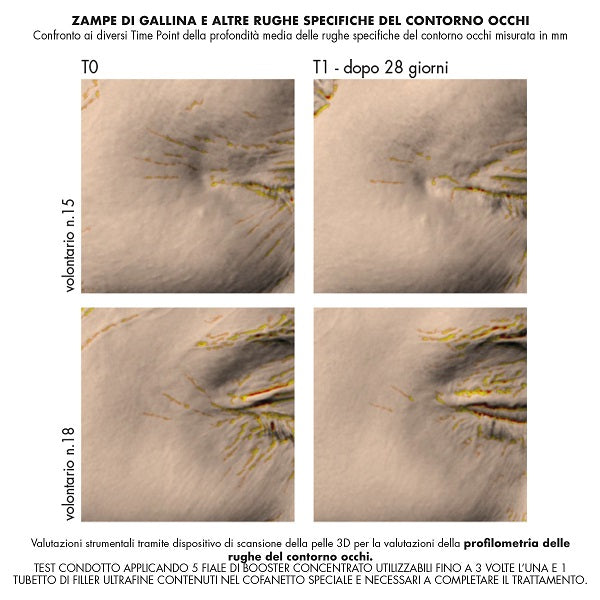 IREOS COFANETTO ANTIRUGHE